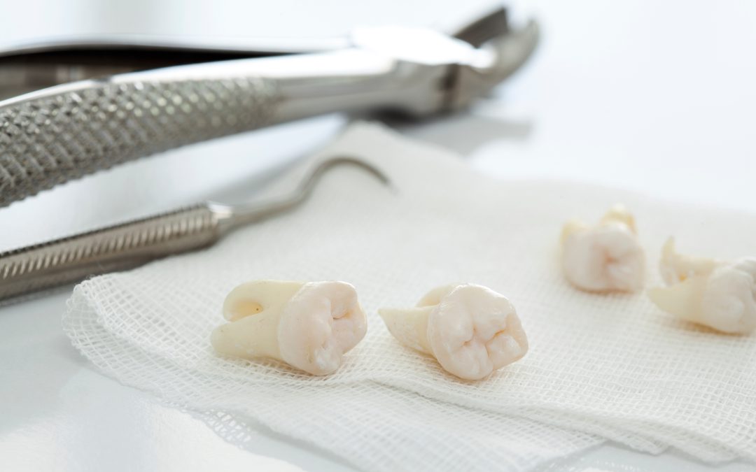 Is Sleep Dentistry in Livingston Safe for Nervous Patients?