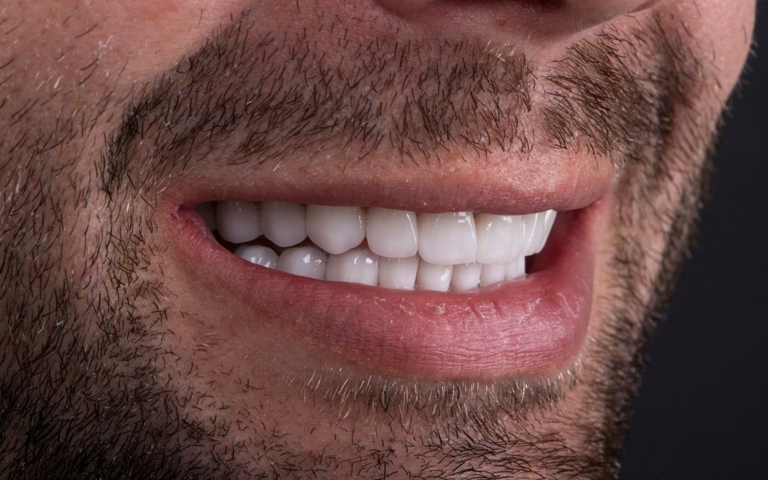 teeth whitening in Livingston
